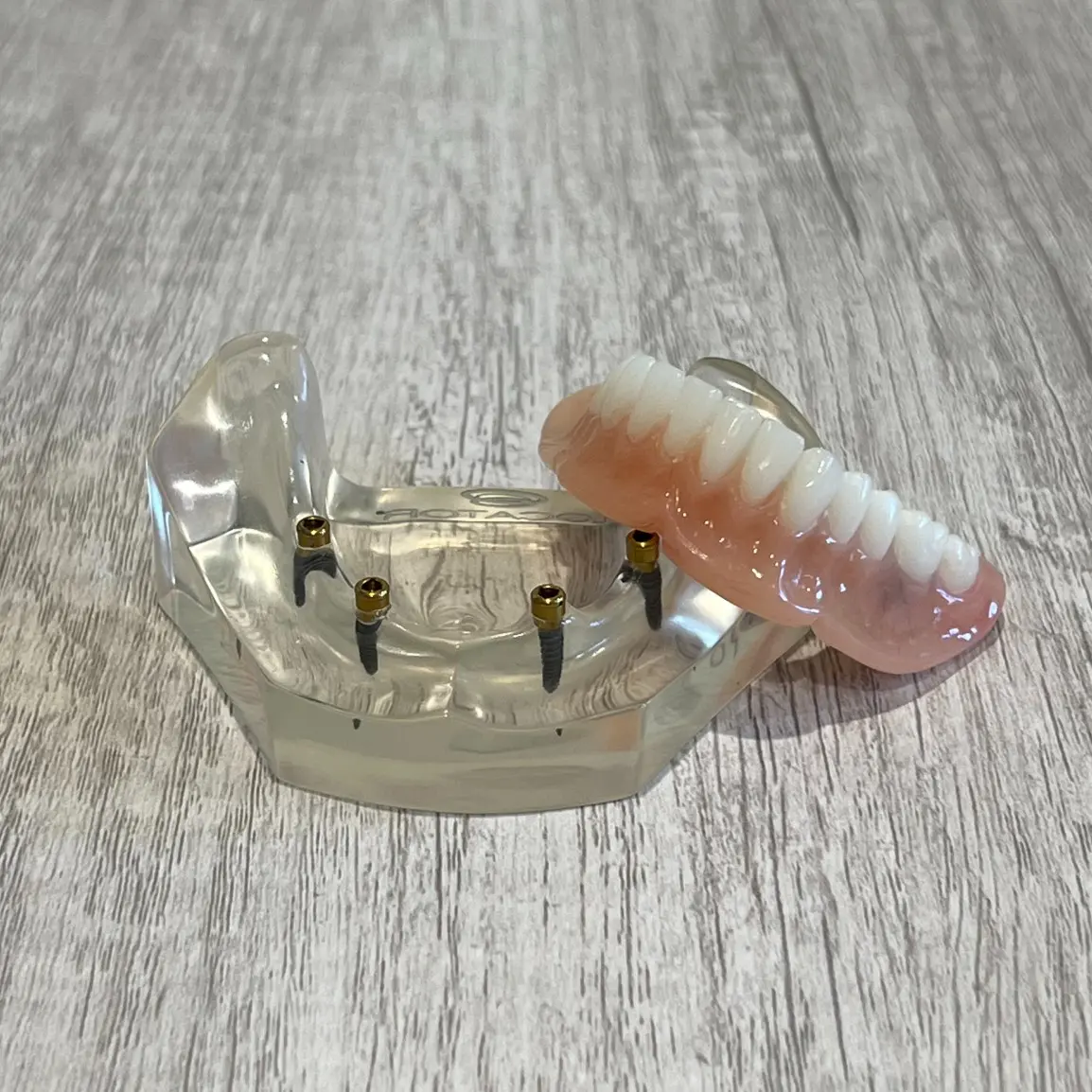 snap-in implant dentures | dental implants park city ut