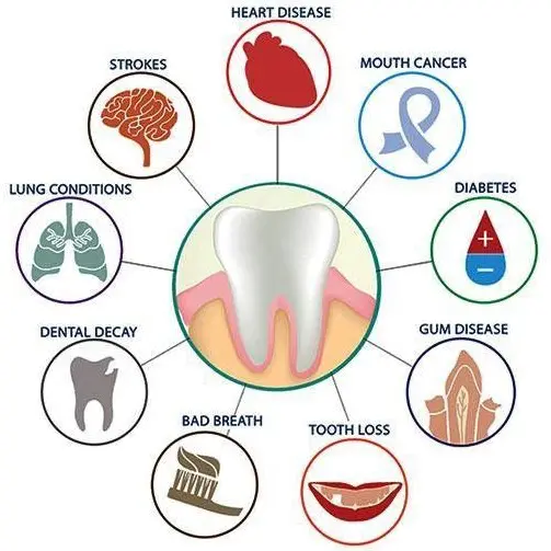 effects of periodontitis | periodontist park city ut