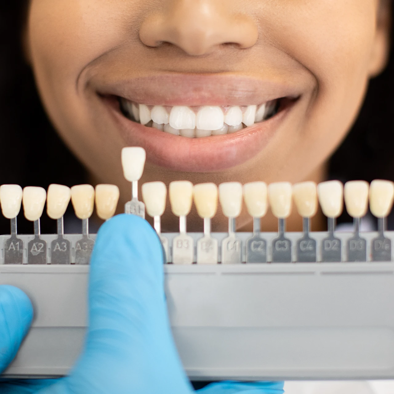 woman comparing different shades of porcelain veneers at the dentist office | best dentist for porcelain veneers park city ut
